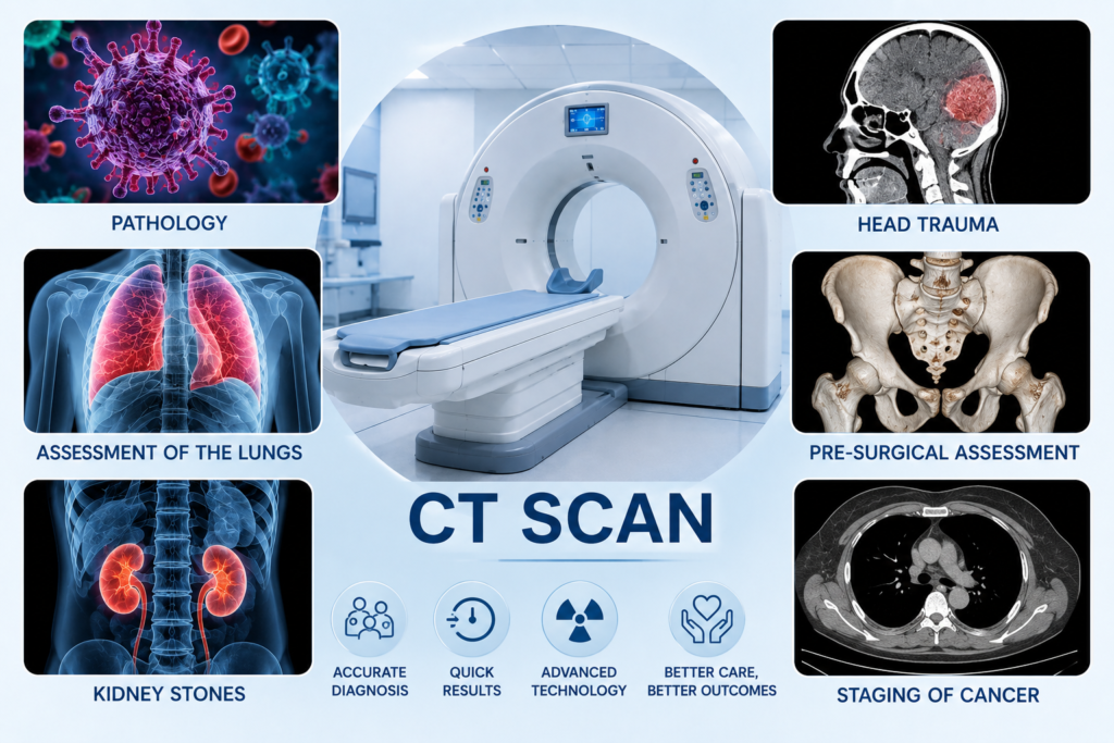 Reasons for a CT scan